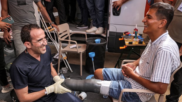 Aid workers, doctors help fit Palestinian amputees with new prosthetic limbs | CBC News