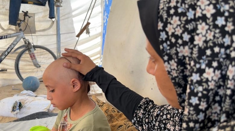 The stress of life in Gaza has taken most of this little girl's hair | CBC News