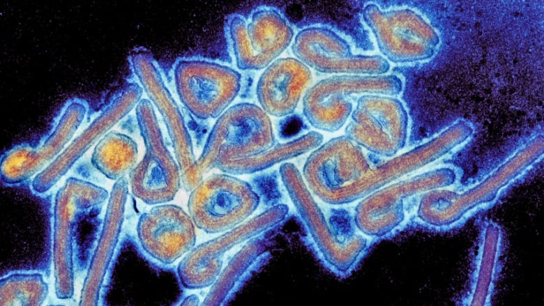 Marburg vaccine study begins in Rwanda | CBC News
