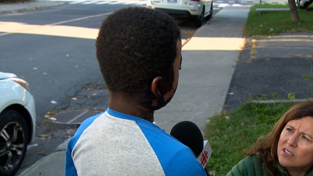 Montreal-area boy severely burned after stranger throws boiling water on him | CBC News