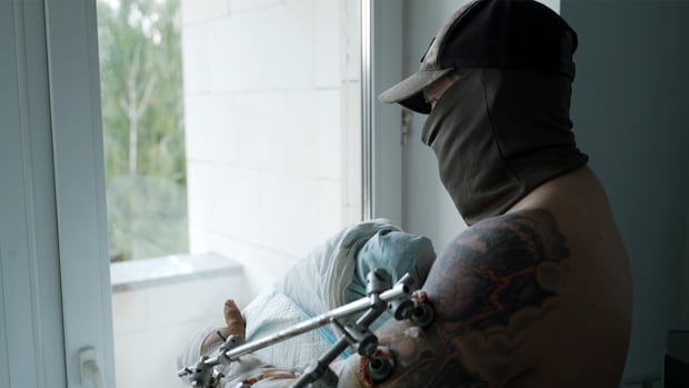 This Canadian was wounded fighting for Ukraine. Here's his survival story | CBC News