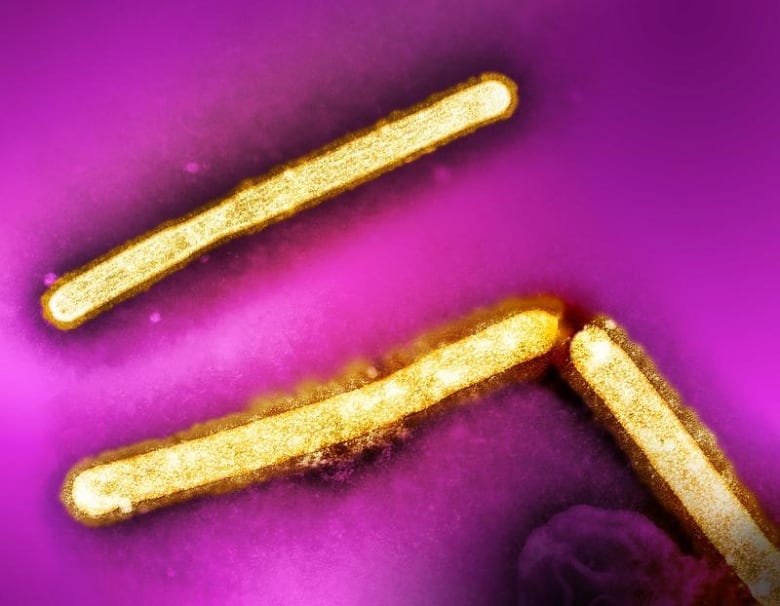 What Canada does to monitor H5N1 avian flu
