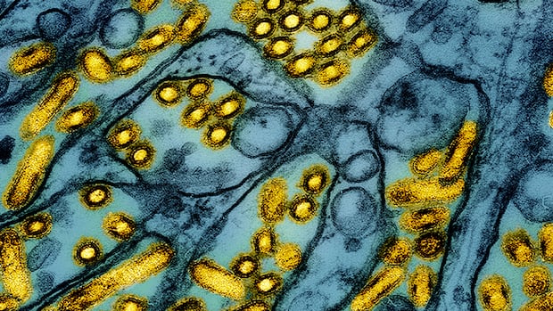 Nevada dairy worker recovers after infection with new strain of bird flu: CDC