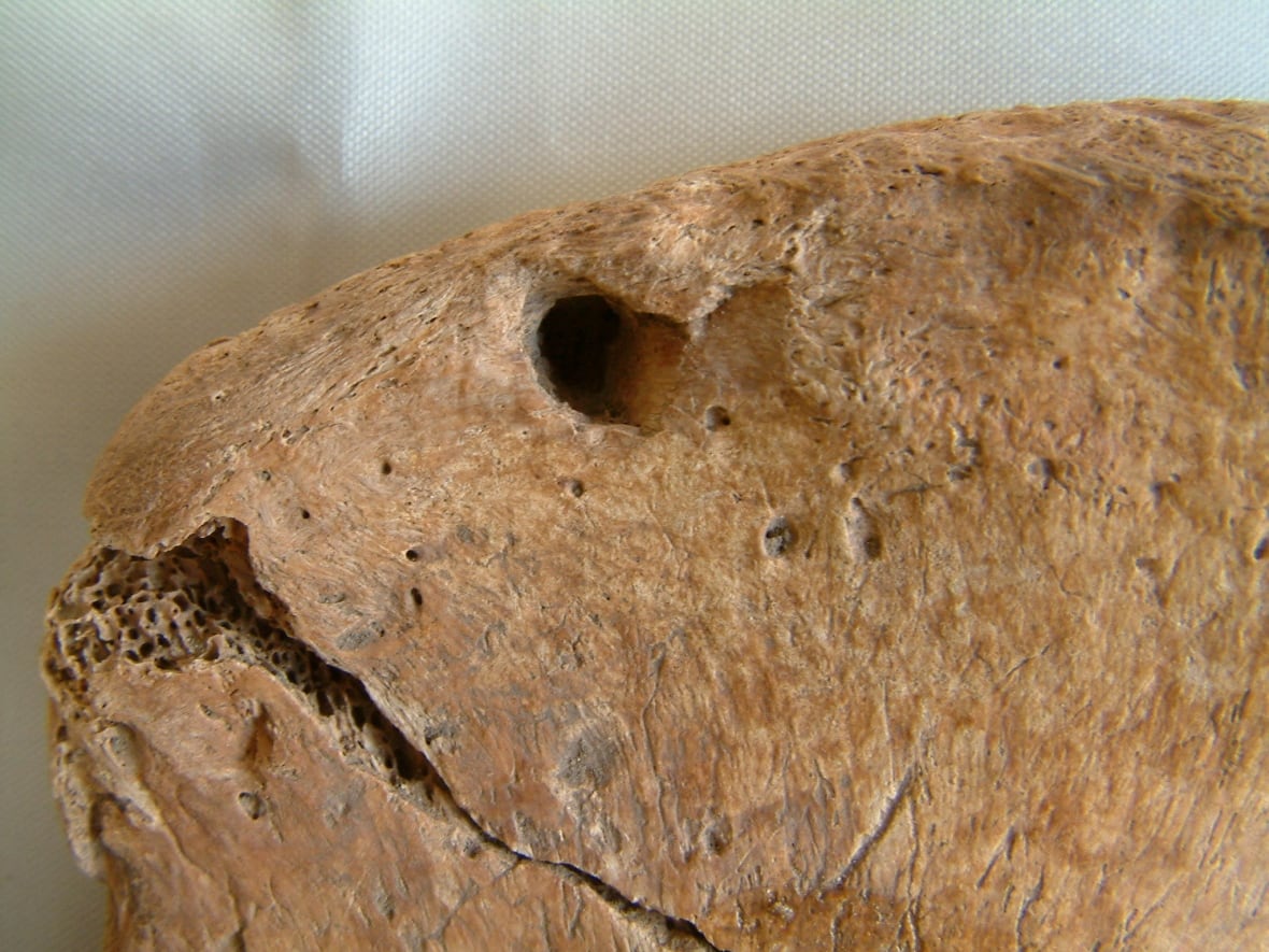Did Roman gladiators really fight animals? This one has the bite marks to prove it