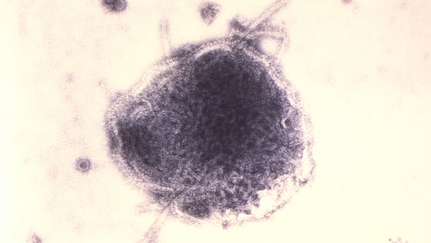 Quebec says measles outbreak has ended