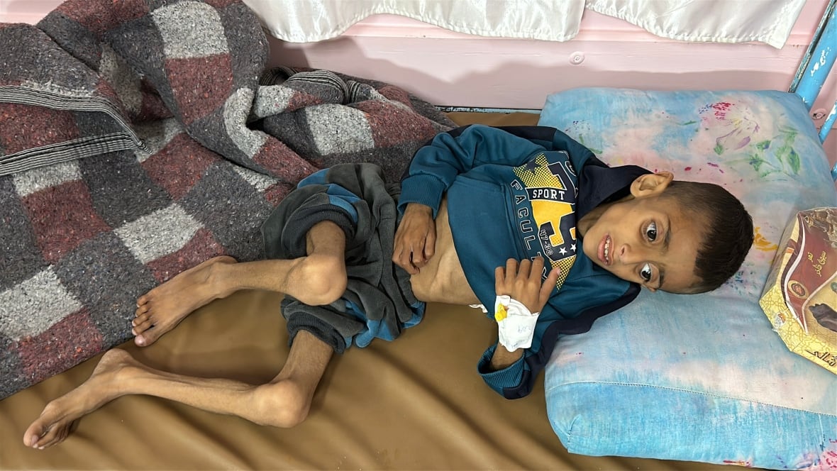 Children face starvation in Gaza as Israel's blockade of food, medication reaches 2 months