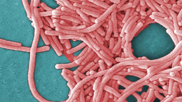 What is legionnaires' disease, the bacterial infection behind outbreaks in Ontario and N.Y.?