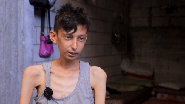 Before he died, this Gaza teen described what it was like to starve
